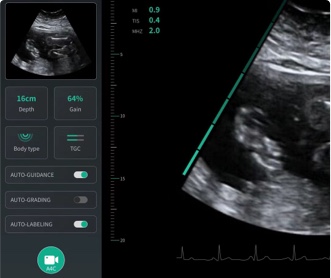 某人工智能研究所醫(yī)療影像軟件UI設(shè)計（保密）